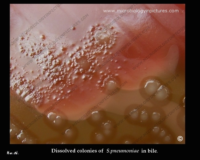 the bile solubility test with pneumococcus